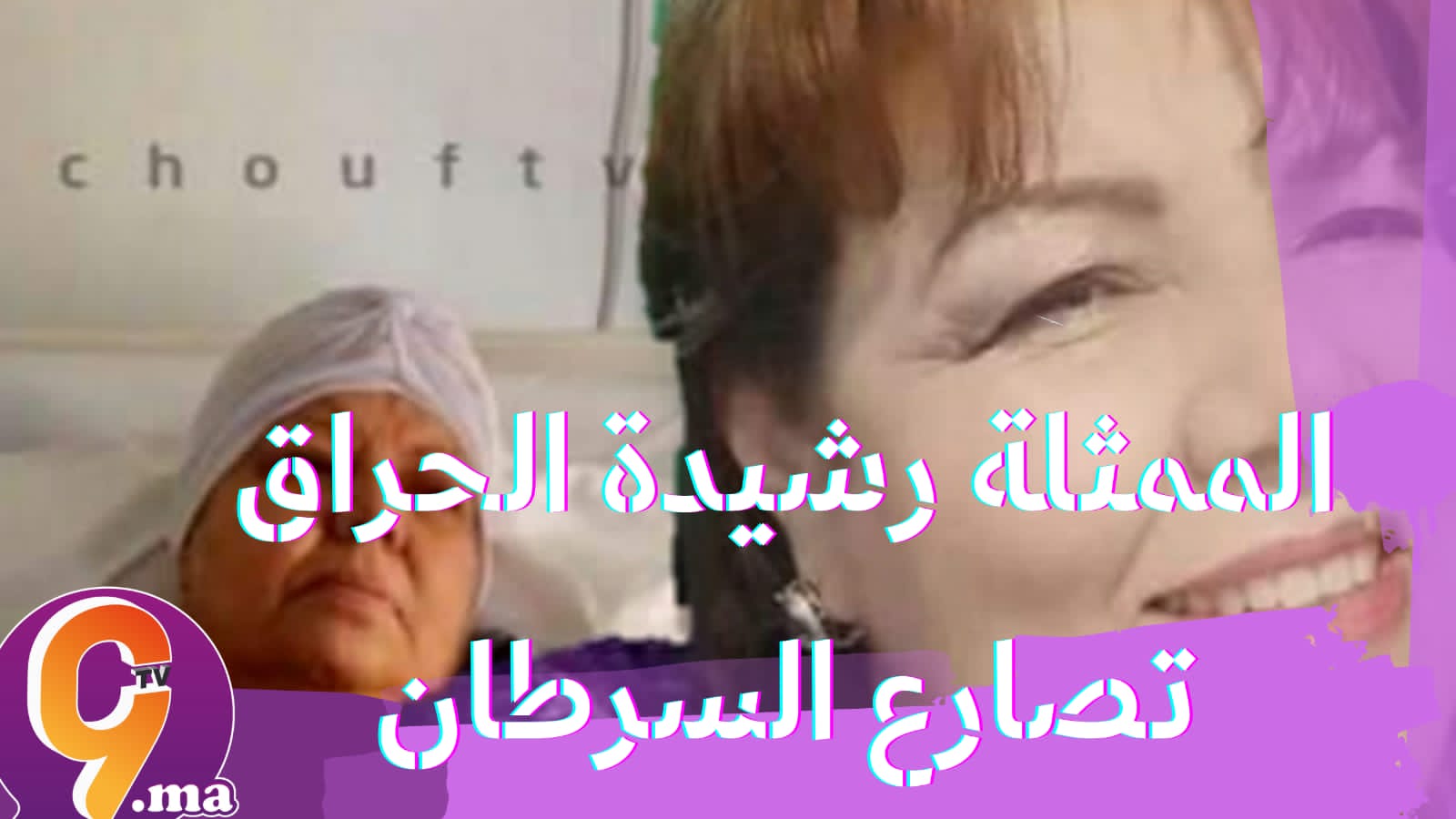 الفنانة رشيدة الحراق في حالة حرجة بسبب مضاعفات مرض السرطان