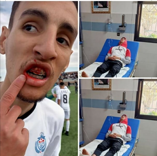 تيزنيت:حكم مبارة اتران ينهي المبارة في مخفر الشرطة.