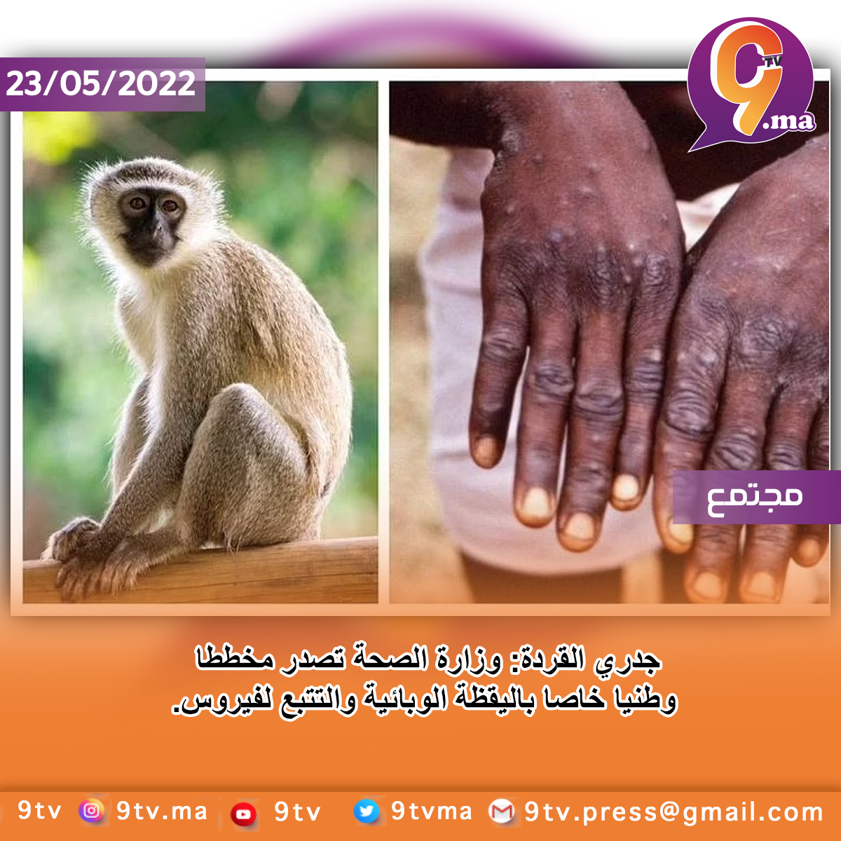 جدري القردة: وزارة الصحة تصدر مخططا وطنيا خاصا باليقظة الوبائية والتتبع لفيروس.